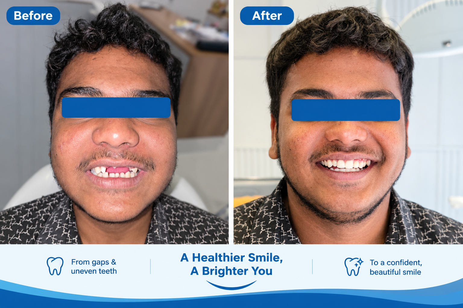 Clinic-provided before and after photographs of a second patient's smile transformation